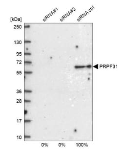 PRPF31 Antibody, Novus Biologicals:Antibodies:Primary Antibodies
